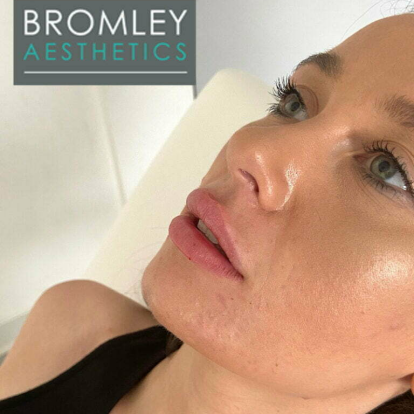 Bromley Aesthetics